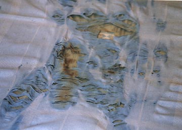 Torso, testicles and upper leg scorches on blue and white cotton sheet where Urandir Oliveira's body rested at the time of the September 15, 2002 transport of his body in a violet light from his bed into an aerial craft. Photograph © 2003 by Linda Moulton Howe.
