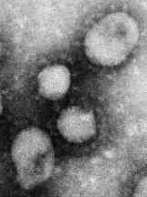 In April 2003, actual SARS coronaviruses under electron microscope © 2003 by Erasmus Medical Centre Department  of Virology, Rotterdam, The Netherlands.