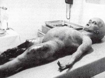 One of two humanoids with six fingers and six toes in alleged 1947 autopsy footage filmed by U. S. military cameraman after extraterrestrial biological entities were retrieved from disc southwest of Socorro, New Mexico. Linda Moulton Howe was told the disc crashed May 31, 1947, southeast of Aragon and 5 to 10 miles north of Elk Mountain on the western end of the Plains of San Agustin. Photographs provided by Ray Santilli, Merlin Productions, London, England © 1996 by Orbital Media Ltd. 