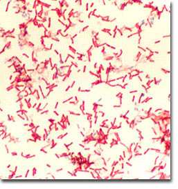 Bacillus anthracis, anthrax bacteria, can form stable spores that are resistant to harsh conditions and extreme temperatures. Photomicrograph courtesy University of Michigan.