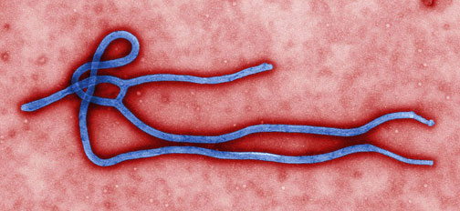 Electronmicroscope image of Ebola filovirus.