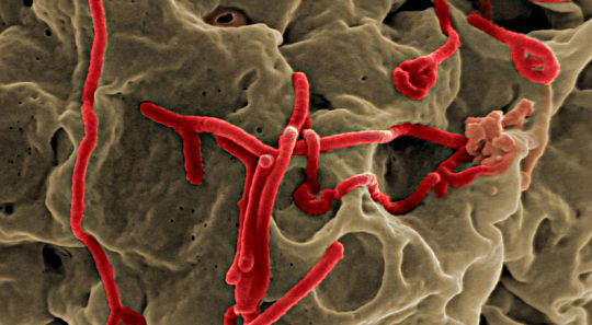 Scanning electron micrograph of Ebola virus in body tissue. Photo NIAID.