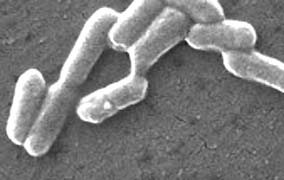 E. coli O157:H7 bacteria magnified 10,961 times can apparently enter tissue of plants such as spinach (right), lettuce and other salad plants. Once embedded, the bacteria cannot be washed away. But heat at 160 degrees F. for two minutes, or boiling at 212 degrees F. for a few seconds, can kill the bacteria. Images courtesy CDC.