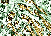 Early 1997 strain of H5N1 avian influenza virus shows golden-brown in this electron micrograph. Virus in 2005 has mutated to more virulence in lab tests. Image 1997 by CDC.