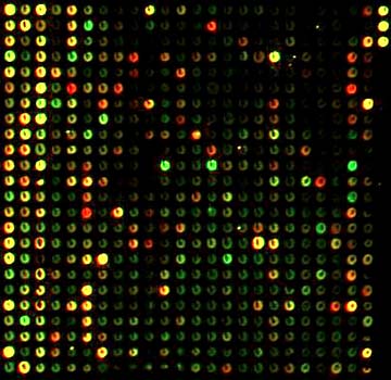 Microarray analysis: the intensity and color of each spot encode information on a specific gene from the tested sample by Leming Shi.