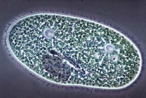 Left: Single-cell protozoan by Science Source. Right: Honey bees atop hive board. Another protozoan, Nosema ceranae, has recently been linked to honey bee die-offs in Spain, France, other European countries and the United States. But Colony Collapse Disorder scientists say it's not the final answer to CCD. Honey bee image © 2007 by Matt Cardy/Getty. 