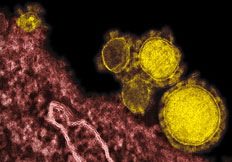 Photomicrograph of new MERS-CoV coronavirus (yellow) that first emerged from the Middle East, but with modern air travel has spread to Europe. A second patient in Paris, France, was hospitalized this week infected by MERS-CoV. Image credit: NIAID/RML. See: W. H. O.