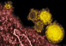 Photomicrograph of new MERS-CoV coronavirus (yellow) that first emerged from the Middle East, but with modern air travel has spread to Europe. A second patient in Paris, France, was hospitalized this week infected by MERS-CoV. Image credit: NIAID/RML. See:  W. H. O.