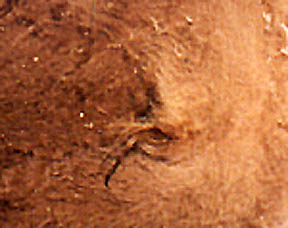 Close-up of hair around urination hole at middle of steer calf's belly. No necropsy done, so not known if penis removed inside abdomen. Photo by Pondera County Sheriff Tom Kuka.