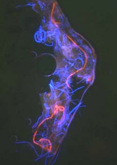 Morgellons fibers in child's lip skin lesion show bright autofluorescence and are not from textiles. Imaging was done using an Olympus Provis Microscope which employs standard wavelengths for rhodamine (Excitation 550 nm/ Emission/565 nm ) and Fluoroscein/alexa 488 (Excitation 494 nm/Emission 519nm). Image courtesy Morgellons Research Foundation.