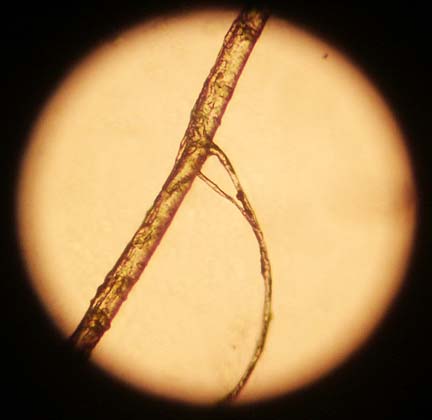 Hair that has an unidentified fibril structure branching off the central shaft.