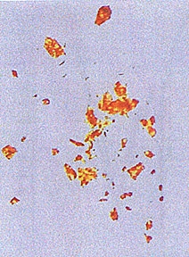 Magnified particles collected from testicles of mutilated bull. Photograph by Phyllis A. Budinger, Analytical Chemist © 2000.