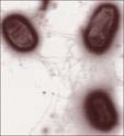 Salmonella typhimurium under microscope. Heating to 185 degrees F. will kill this bacteria.