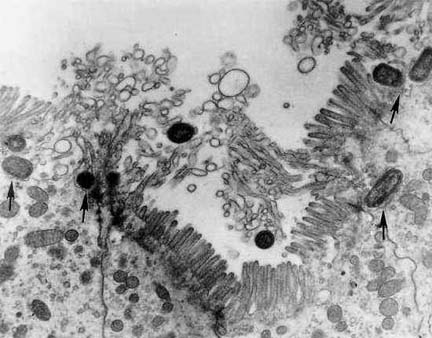 Electron photomicrograph demonstrating invasion of guinea pig ileal epithelial cells by Salmonella typhimurium. Arrows point to invading Salmonella organisms. Photomicrograph Courtesy Akio Takeuchi, Walter Reed Army Institute of Research.