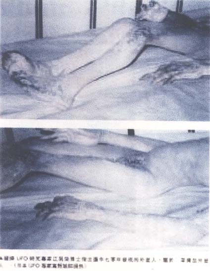 "Hong Kong Alien" computer images of non-human feet, legs and hands distributed on the Internet in 1995. The Chinese text translation allegedly says: "Based on a source from the Japanese UFO Institute, the picture or photograph shows the 1970 alien incident." Spelling of location was not clear, but could be Gongzui on Dadu River southwest of Leshan, China.