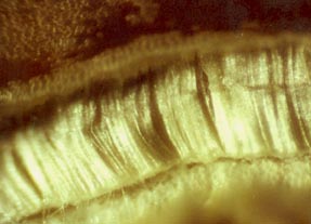 Fibers of insect cocoon formed on seed by larva going into pupation. Photomicrograph 40X © 2003 by W. C. Levengood.