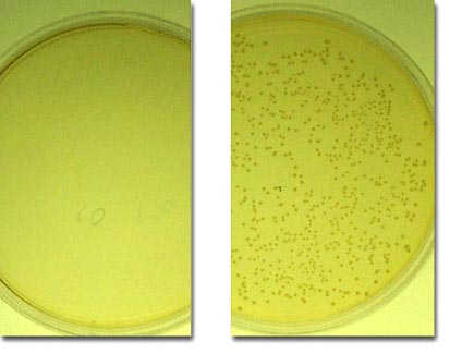 Dish on right contains bacteria spores similar to anthrax. Dish on left shows what happened to spores after treatment with nanoemulsion bio-decontaminant developed by Dr. James Baker and NanoBio Corp, Ann Arbor, Michigan. Photograph courtesy University of Michigan Center for Biological Nanotechnology.