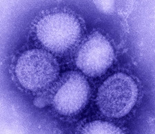 Click for podcast. New England Journal of Medicine on October 8, 2009, reports CDC research that indicates 7% mortality in U. S. 2009 H1N1 cases - higher than normal seasonal flu. H1N1 cases began doubling each week in September 2009. Further, a virulent strain of H3N2 is coming north from Southern Hemisphere. Novel 2009 H1N1 photomicrograph by CDC.