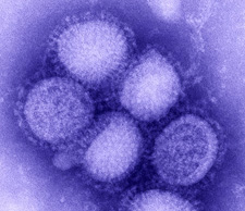 New England Journal of Medicine on October 8, 2009, reports CDC research that indicates 7% mortality in U. S. H1N1 cases - above normal seasonal flu. H1N1 cases doubling each week and virulent strain of H3N2 coming north from Southern Hemisphere. Novel 2009 H1N1 photomicrograph by CDC.