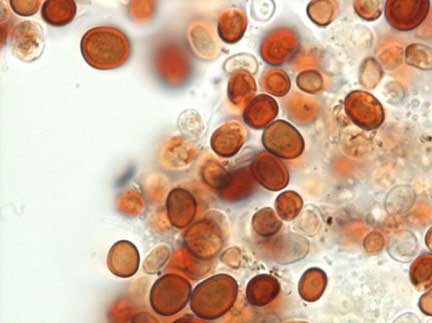 August 2007, red and white cells collected from red rain that fell for a third time on the state of Kerala, India. Photomicrograph © 2007 by Godfrey Louis, Ph.D.