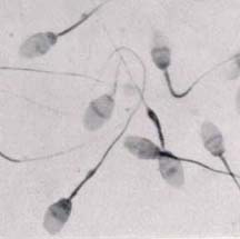 Sperm cells under microscope. Source Thphys.physics.