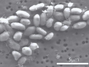 GFAJ-1 is a bacteria that can live without phosphorus, replacing it with arsenic. Photomicrograph source Science/AACS.