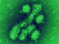 A/H1N1 flu virus is seen in an image taken using an electron microscope, at National Microbiology Laboratory, Public Health Agency of Canada.