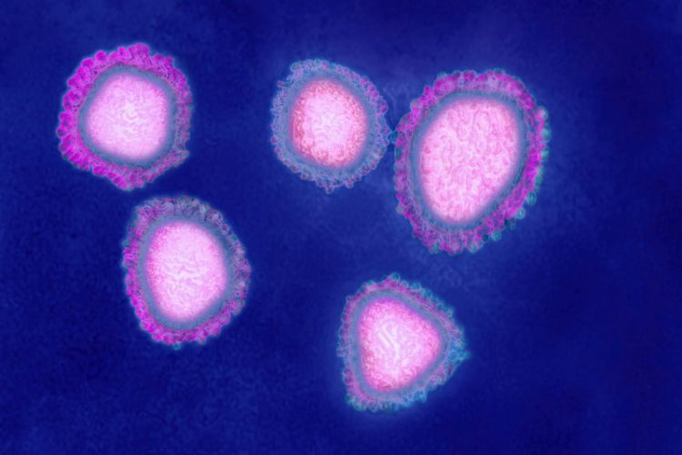 Colored image of coronaviruses made from a transmission electron microscopy.