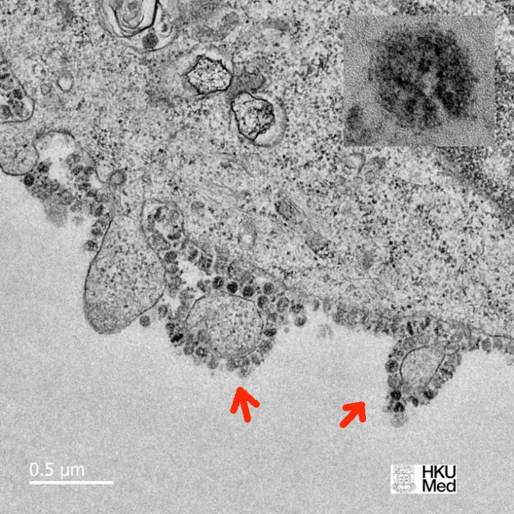 Thin-section electron micrograph of 2019 novel coronavirus grown in cells at the University of Hong Kong. “Each infected cell produces thousands of new infectious virus particles, which can go on to infect new cells.” Image from John Nicholls, Leo Poon and Malik Peiris, Univ. of Hong Kong, February 3, 2020.